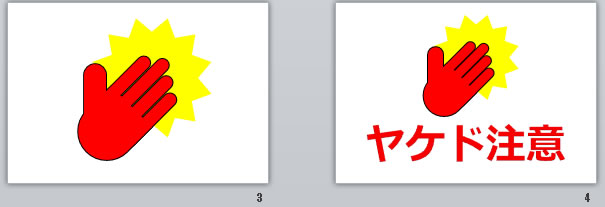 ヤケド注意の貼り紙画像