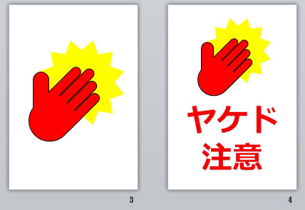 ヤケド注意の貼り紙画像