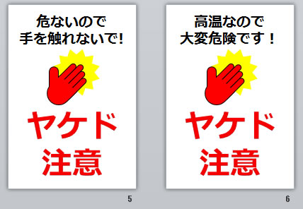 ヤケド注意の貼り紙画像